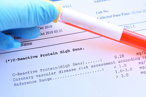 A C-reactive protein CRP test panel