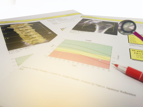 DEXA scan results