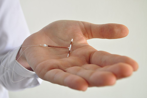 A woman being offered an IUD for birth control