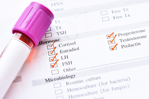 A testing card showing a typical hormone panel 