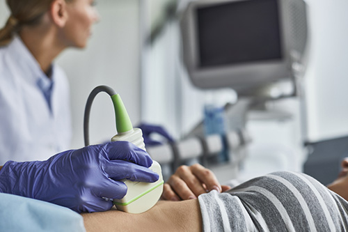 Woman getting ultrasound to check for uterine fibroids