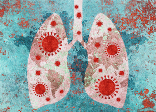 Close up of lungs affected by Covid-19