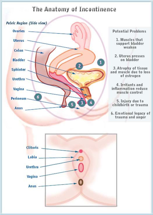 Incontinence Diagram Incontinence Diagram